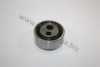 AUTOMEGA 300829029 Tensioner Pulley, timing belt
